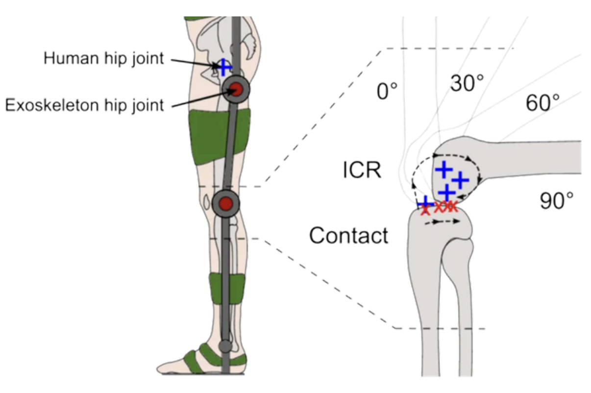 Technical diagram showing rigid exoskeleton misalignment at the knee